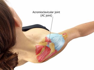 AC joint pain